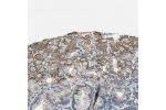 Immunohistochemical staining of human cerebral cortex shows moderate cytoplasmic positivity in neuronal cells.