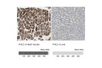 Immunohistochemistry analysis in human heart muscle and liver tissues using HPA005922 antibody. Corresponding FHL2 RNA-seq data are presented for the same tissues.