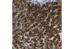 Immunohistochemical staining of human liver shows strong nuclear and cytoplasmic positivity in hepatocytes.