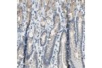 Immunohistochemical staining of human stomach shows moderate membranous positivity in glandular cells.