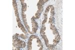 Immunohistochemical staining of human prostate shows moderate cytoplasmic positivity in glandular cells.