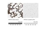 Immunohistochemistry analysis in human bone marrow and cerebral cortex tissues using Anti-PRTN3 antibody. Corresponding PRTN3 RNA-seq data are presented for the same tissues.