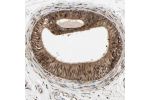Immunohistochemical staining of human epididymis shows strong nuclear and cytoplasmic positivity in glandular cells.