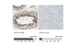 Immunohistochemistry analysis in human testis and liver tissues using Anti-CCT5 antibody. Corresponding CCT5 RNA-seq data are presented for the same tissues.
