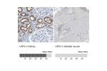 Immunohistochemistry analysis in human kidney and skeletal muscle tissues using HPA005980 antibody. Corresponding LRP2 RNA-seq data are presented for the same tissues.
