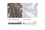 Immunohistochemistry analysis in human fallopian tube and testis tissues using Anti-CAPN1 antibody. Corresponding CAPN1 RNA-seq data are presented for the same tissues.