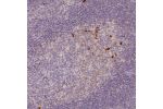 Immunohistochemical staining of human tonsil shows strong cytoplasmic positivity in subset of germinal center cells.