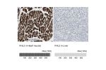 Immunohistochemistry analysis in human heart muscle and liver tissues using HPA006028 antibody. Corresponding FHL2 RNA-seq data are presented for the same tissues.