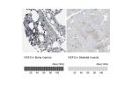 Immunohistochemistry analysis in human bone marrow and skeletal muscle tissues using HPA006040 antibody. Corresponding NCF2 RNA-seq data are presented for the same tissues.
