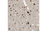Immunohistochemical staining of human cerebral cortex shows strong nuclear and cytoplasmic positivity in neuronal cells.
