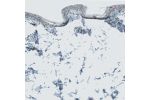 Immunohistochemical staining of human Skin shows moderate nuclear positivity in keratinocytes.
