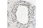 Immunohistochemical staining of human testis shows moderate to strong nuclear positivity in cells in seminiferous ducts.