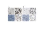 Immunohistochemical staining of human cerebral cortex, gastrointestinal, lymphoid tissues and testis using Anti-NFIA antibody HPA006111 (A) shows similar protein distribution across tissues to independent antibody HPA008884 (B).
