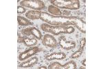 Immunohistochemical staining of human kidney shows moderate cytoplasmic positivity in cells in tubules.