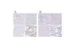 Immunohistochemical staining of human kidney, liver, skeletal muscle and testis using Anti-CXorf67 antibody HPA006128 (A) shows similar protein distribution across tissues to independent antibody HPA004003 (B).