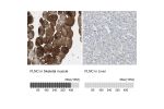 Immunohistochemistry analysis in human skeletal muscle and liver tissues using HPA006135 antibody. Corresponding FLNC RNA-seq data are presented for the same tissues.