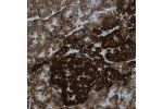 Immunohistochemical staining of human pancreas shows strong cytoplasmic positivity in exocrine glandular cells.