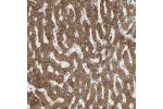 Immunohistochemical staining of human liver shows strong cytoplasmic positivity in hepatocytes.