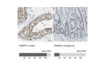 Immunohistochemistry analysis in human testis and duodenum tissues using Anti-FKBP4 antibody. Corresponding FKBP4 RNA-seq data are presented for the same tissues.
