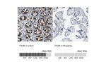 Immunohistochemistry analysis in human colon and placenta tissues using HPA006154 antibody. Corresponding PIGR RNA-seq data are presented for the same tissues.