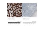 Immunohistochemistry analysis in human kidney and tonsil tissues using HPA006155 antibody. Corresponding PDZK1 RNA-seq data are presented for the same tissues.