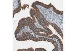 Immunohistochemical staining of human fallopian tube shows strong cytoplasmic positivity in glandular cells.