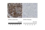 Immunohistochemistry analysis in human lymph node and pancreas tissues using HPA006162 antibody. Corresponding SP140 RNA-seq data are presented for the same tissues.
