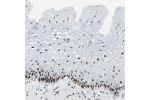 Immunohistochemical staining of human esophagus shows strong nuclear positivity in squamous epithelial cells.