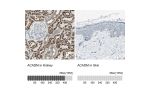Immunohistochemistry analysis in human kidney and skin tissues using Anti-ACADM antibody. Corresponding ACADM RNA-seq data are presented for the same tissues.