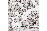 Immunohistochemical staining of human placenta shows strong nuclear positivity in trophoblastic cells.