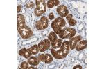 Immunohistochemical staining of human kidney shows strong cytoplasmic and nuclear positivity in cells in tubules.