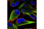 Immunofluorescent staining of human cell line RH-30 shows localization to intermediate filaments.