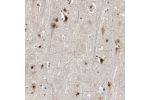 Immunohistochemical staining of human cerebral cortex shows strong nuclear positivity in neuronal cells.