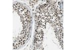 Immunohistochemical staining of human endometrium shows nuclear positivity in glandular cells and cels in the endometrial stroma.