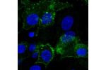 Immunofluorescent staining of human cell line Hep G2 shows localization to plasma membrane.