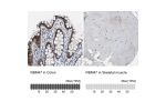 Immunohistochemistry analysis in human colon and skeletal muscle tissues using HPA006347 antibody. Corresponding RBM47 RNA-seq data are presented for the same tissues.