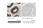 Immunohistochemistry analysis in human testis and skeletal muscle tissues using HPA006360 antibody. Corresponding HPRT1 RNA-seq data are presented for the same tissues.