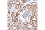 Immunohistochemical staining of human kidney shows moderate nuclear positivity in cells in a subset of renal tubules.