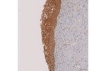 Immunohistochemical staining of human small intestine shows strong cytoplasmic positivity in glandular cells.