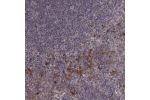 Immunohistochemical staining of human tonsil shows strong cytoplasmic positivity in subset of non-germinal center cells.