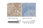 Immunohistochemistry analysis in human heart muscle and lymph node tissues using HPA006462 antibody. Corresponding S100A1 RNA-seq data are presented for the same tissues.