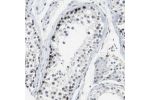 Immunohistochemical staining of human testis shows moderate to strong nuclear positivity in cells in seminiferous ducts.