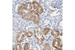 Immunohistochemical staining of human kidney shows moderate cytoplasmic and nuclear positivity in renal tubules.