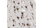 Immunohistochemical staining of human cerebral cortex shows strong nuclear and cytoplasmic positivity in neuronal cells.