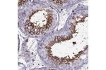 Immunohistochemical staining of human testis shows strong membranous positivity in cells in seminiferous ducts.