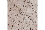 Immunohistochemical staining of human cerebral cortex shows strong cytoplasmic positivity in glial cells.