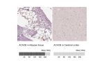Immunohistochemistry analysis in human adipose tissue and cerebral cortex tissues using HPA006554 antibody. Corresponding ACACB RNA-seq data are presented for the same tissues.