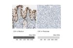 Immunohistochemistry analysis in human rectum and pancreas tissues using HPA006558 antibody. Corresponding CA1 RNA-seq data are presented for the same tissues.