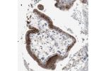 Immunohistochemical staining of human placenta shows strong granular cytoplasmic positivity in trophoblastic cells.