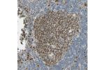 Immunohistochemical staining of human lymph node shows distinct nuclear positivity in germinal center cells.